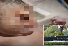 Pertanda Apa Ini, Bayi Lahir Satu Mata Di RS Sekayu, Bukan Hoax
