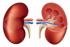 10 Ciri-Ciri Gagal Ginjal Stadium Awal yang Harus Diketahui