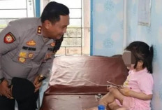 Kasus Bocah Patah Kaki Permanen di Nias Selatan, Tante Jadi Tersangka 